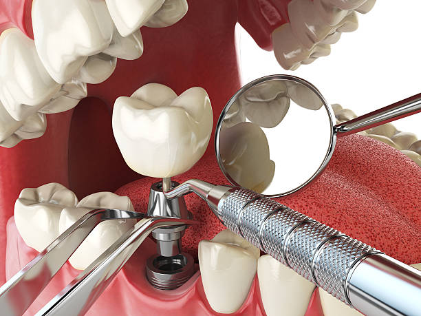 Best Emergency Gum Treatment in Darien, IL